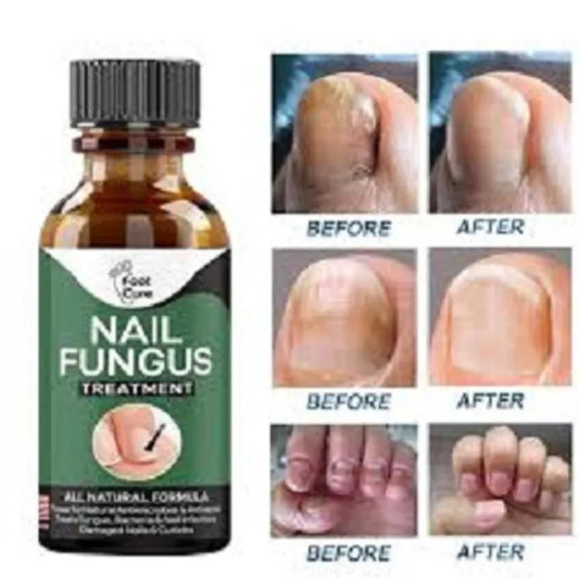 Fungus Removal Gel
